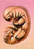 fetus1