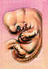 fetus2