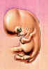 fetus3